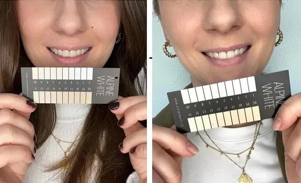 Weissere Zähne mit Alpine White: Vorher / Nachher